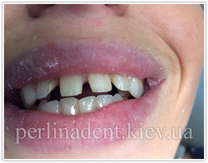лечение зубов на борщаговке