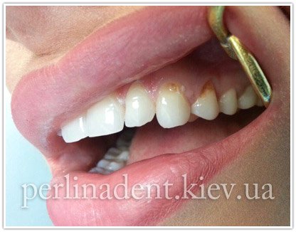 Эстетическая стоматология в Киеве