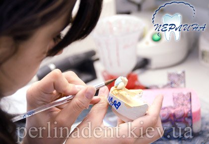 Изготовление зубных протезов