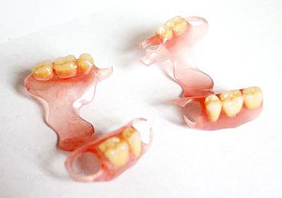 Нейлоновые зубные протезы цена 
