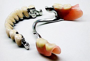 Протезирование зубов недорого 
