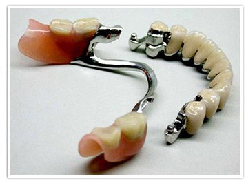 Знімні зубні протези