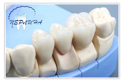 Протезування зубів металокераміка