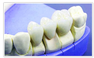 Ультразвукова чистка зубів, ціна
