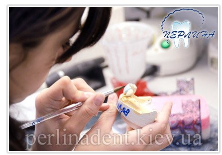 Виготовлення зубних протезів