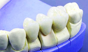 Ультразвуковая чистка зубов, цена