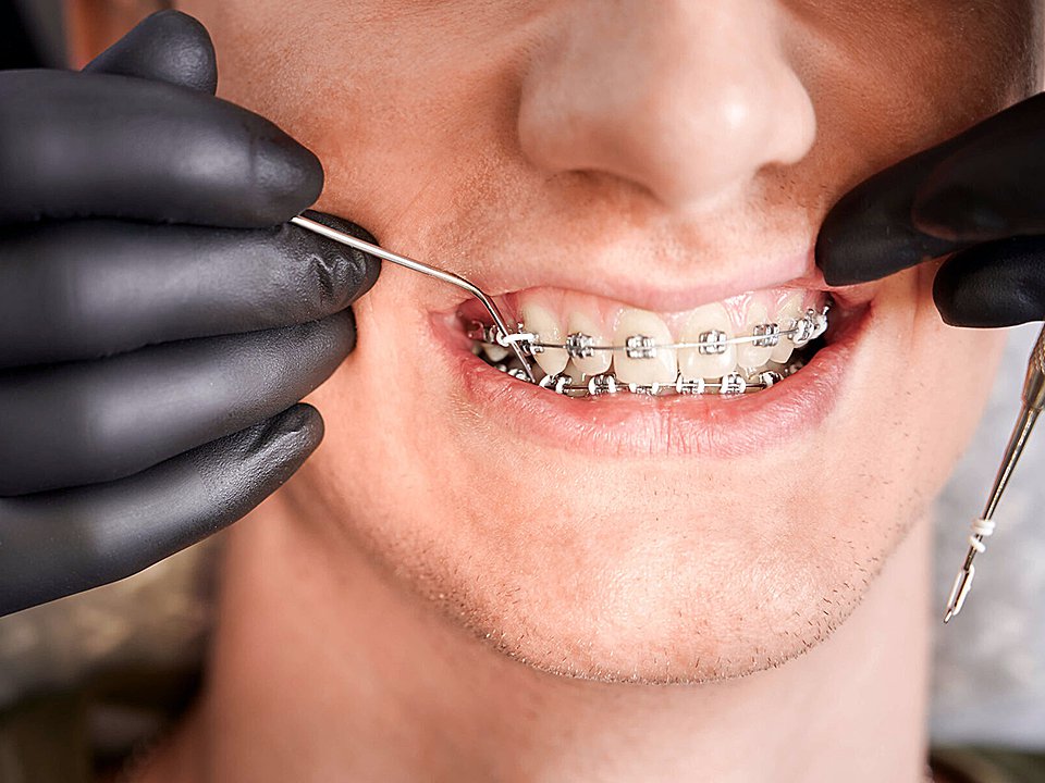 ������� �������