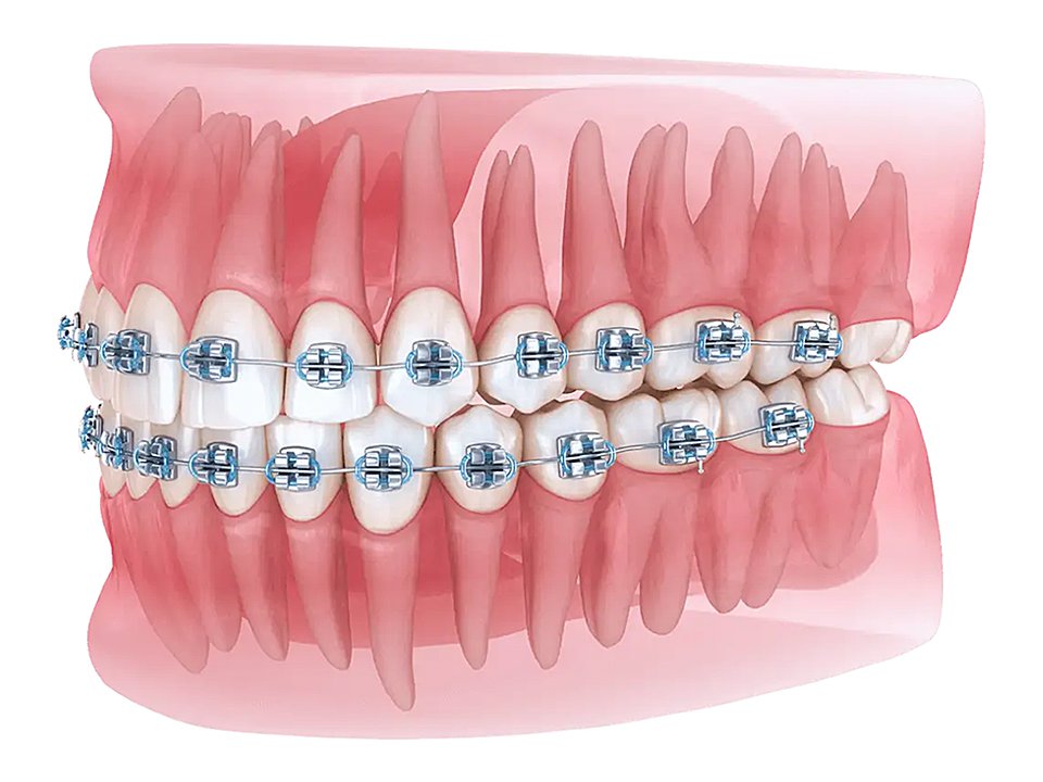 ������� ������� ����