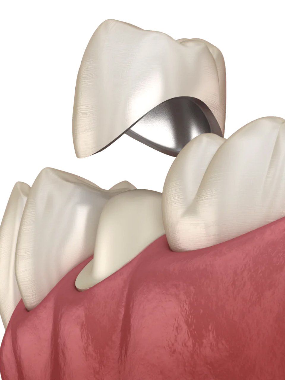 �������������� ������� ��������� ��������